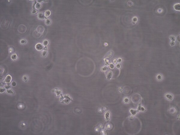 ANBL-6 Plasma Cell Myeloma Cell Line | SCC429